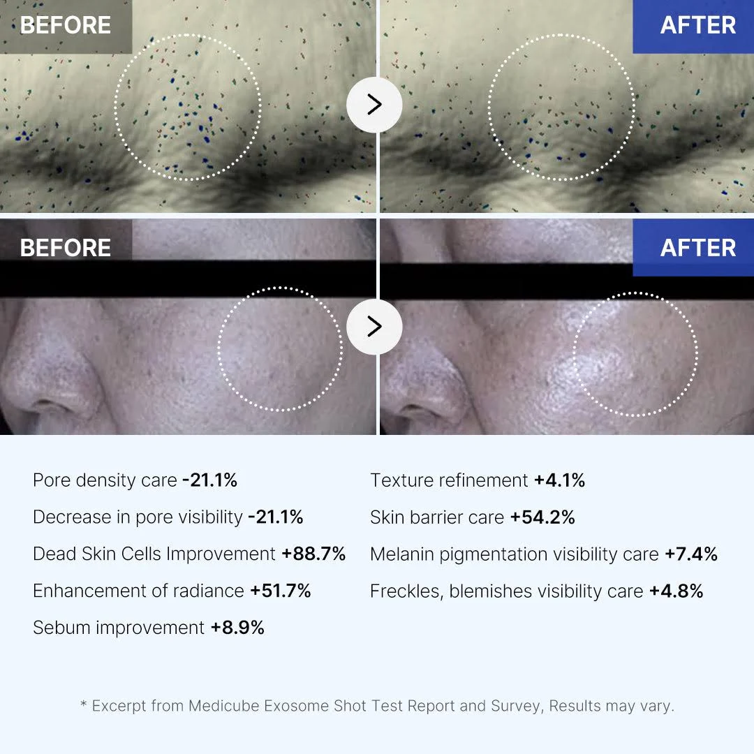 Medicube One Day Exosome Shot 7500 | Optimizes Cell Renewal