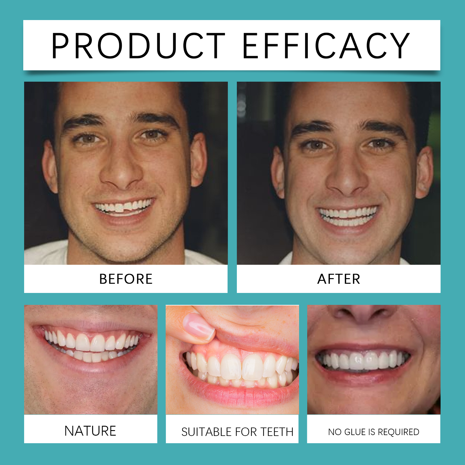 Perfect Smile Veneer, Removable Dental Veneer, Upper and Lower Veneers, Instant Smile Transformation, Cosmetic Dental Solution, Natural-Looking Veneers, Comfortable Veneer Fit, Easy-to-Use Dental Veneers, Smile Enhancement, Non-Invasive Veneers, Affordable Smile Makeover, Custom Fit Veneers, Bright Smile Veneers, Teeth Whitening Effect, Veneers for Everyday Use, Durable Dental Veneers, Perfect Teeth Cover, Temporary Veneers, Smile Confidence Boost, Dental Aesthetic Solution.