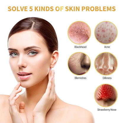 Blackhead Remover Mask, Pore Cleansing Mask, Deep Cleansing Mask, Blackhead Peel-Off Mask, Charcoal Face Mask, Blackhead Removal Treatment, Skin Purifying Mask, Detoxifying Face Mask, Oil Control Mask, Acne Treatment Mask, Exfoliating Mask, Pore Minimizing Mask, Skin Brightening Mask, Sebum Control Mask, Gentle Exfoliation Mask, Facial Detox Mask, Skin Refining Mask, Easy Peel-Off Mask, Natural Blackhead Mask, Clear Skin Mask.