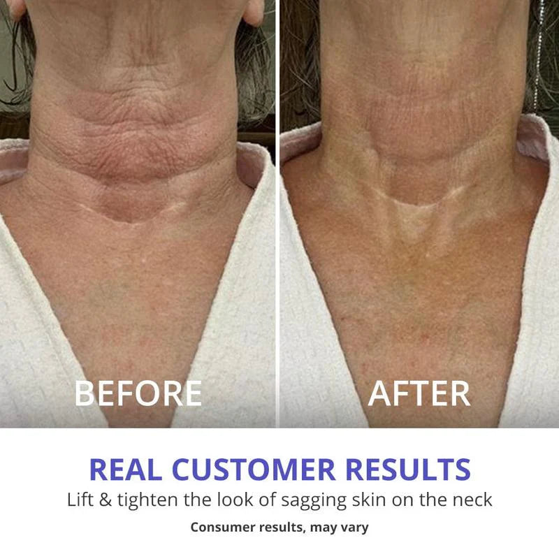 GoPure Tighten and Lift Neck Cream, Neck Firming Cream, Skin Tightening Neck Cream, Anti-Aging Neck Cream, Firming and Lifting Neck Treatment, Rejuvenating Neck Cream, Neck and Décolleté Cream, Hydrating Neck Cream, Smooth and Lift Neck Cream, Anti-Wrinkle Neck Cream, Collagen-Boosting Neck Cream, Neck Skin Care, Skin Elasticity Boosting Cream, Firm and Tighten Neck Skin, Neck Firming and Hydration, Neck and Jawline Treatment, Visible Neck Lift Cream, Nourishing Neck Cream, Non-Greasy Neck Cream, Youthful 