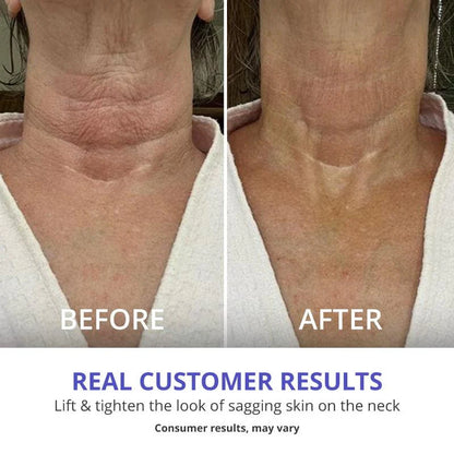 GoPure Tighten and Lift Neck Cream, Neck Firming Cream, Skin Tightening Neck Cream, Anti-Aging Neck Cream, Firming and Lifting Neck Treatment, Rejuvenating Neck Cream, Neck and Décolleté Cream, Hydrating Neck Cream, Smooth and Lift Neck Cream, Anti-Wrinkle Neck Cream, Collagen-Boosting Neck Cream, Neck Skin Care, Skin Elasticity Boosting Cream, Firm and Tighten Neck Skin, Neck Firming and Hydration, Neck and Jawline Treatment, Visible Neck Lift Cream, Nourishing Neck Cream, Non-Greasy Neck Cream, Youthful 