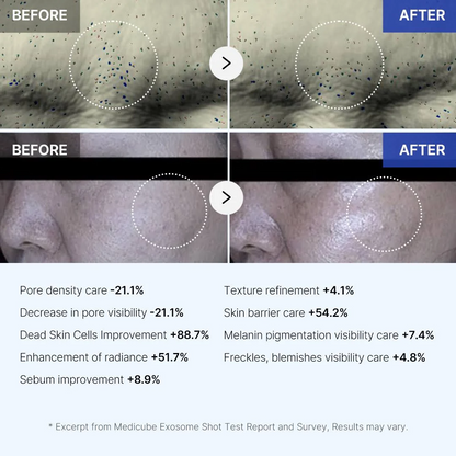 Medicube One Day Exosome Shot 7500 | Optimizes Cell Renewal