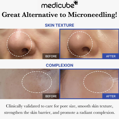 Medicube One Day Exosome Shot 7500 | Optimizes Cell Renewal